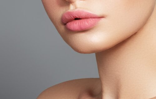 woman who has had lip fillers