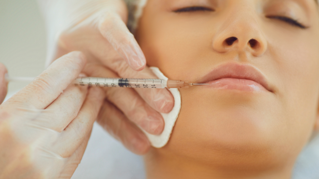 A women receiving dermal lip fillers from a professional aesthetician.