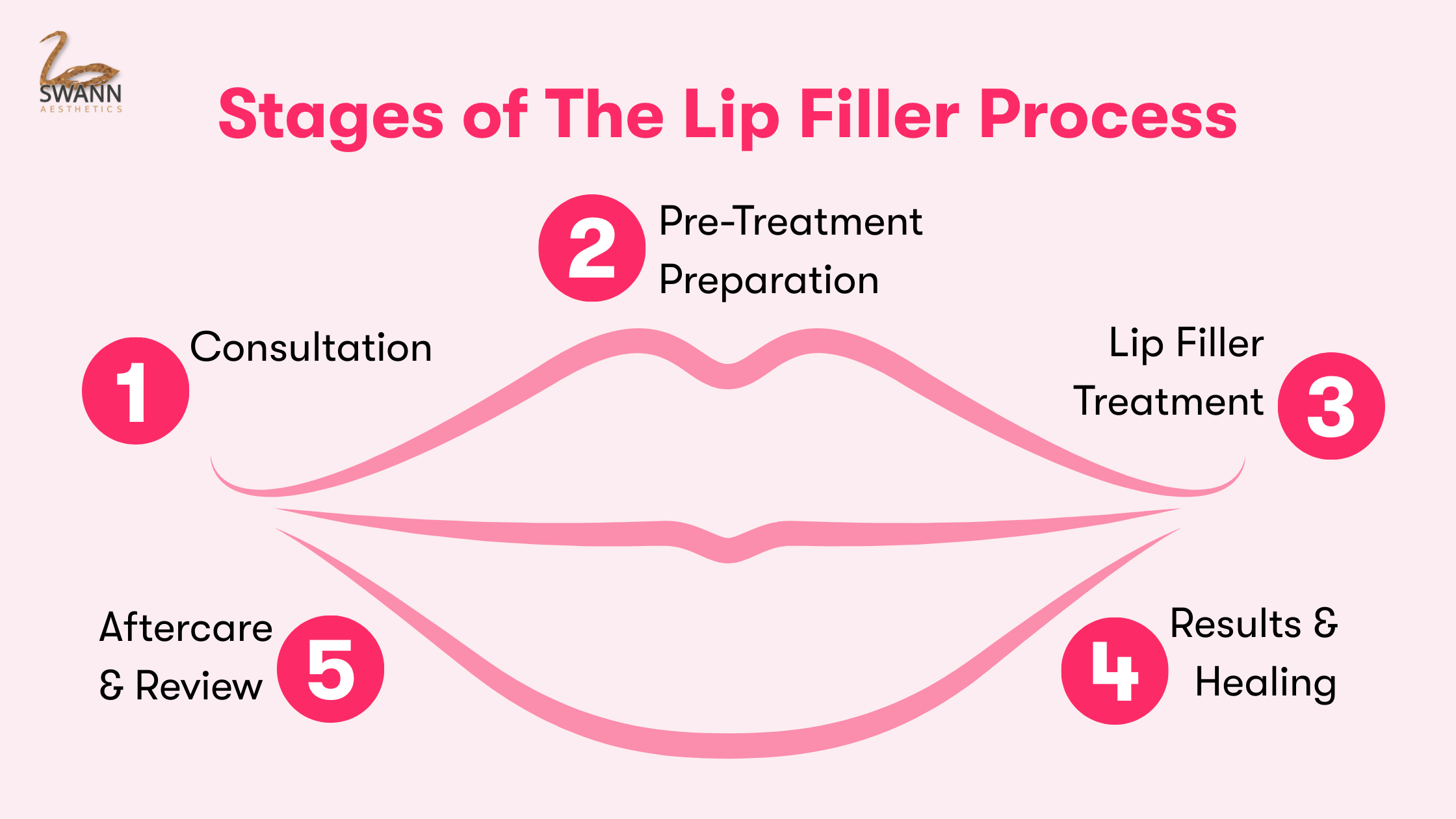Infographic showing the different stages of the lip filler process, from consultation through to aftercare.