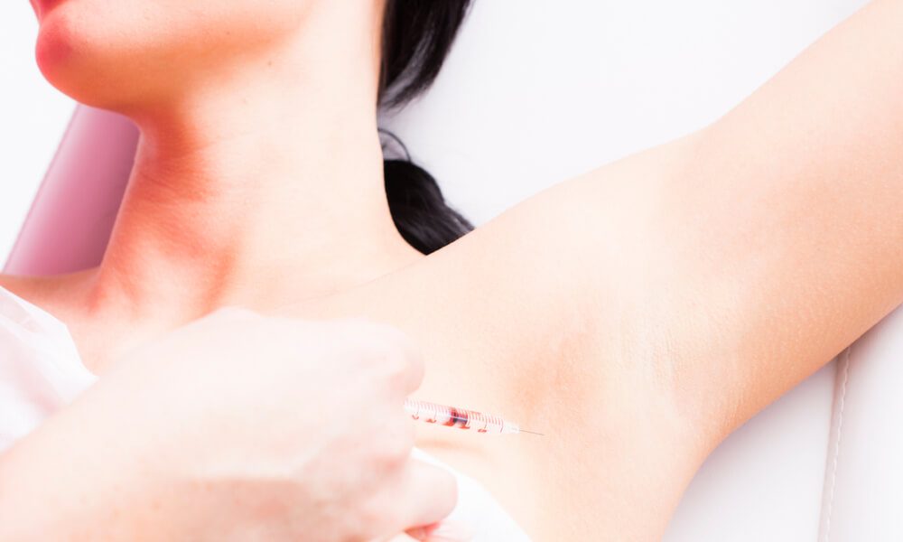 woman receiving botox injection to her armpit